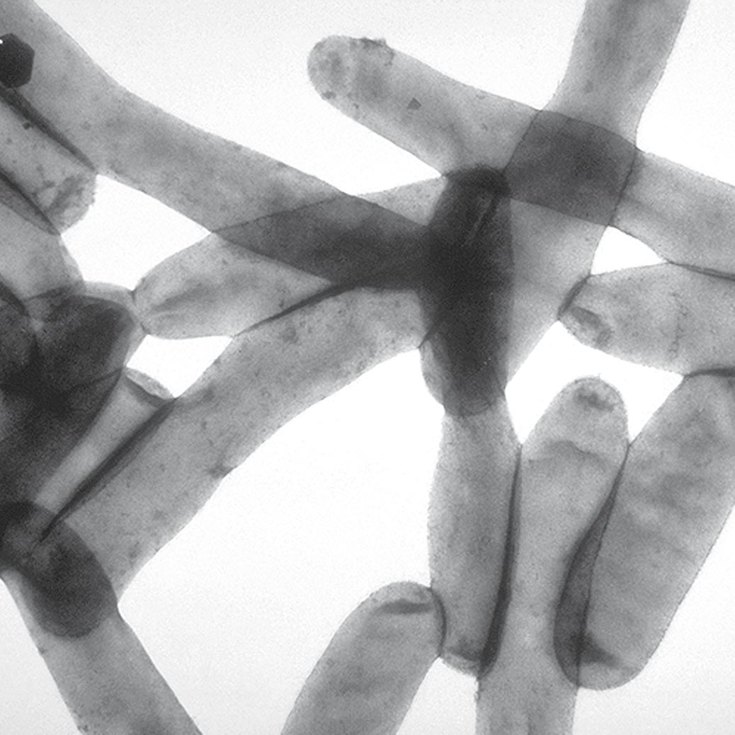 legionella-1